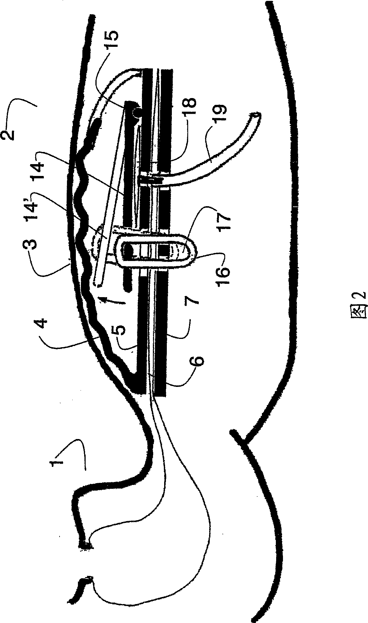 Chest retraction simulating device and medical patient simulator having the device