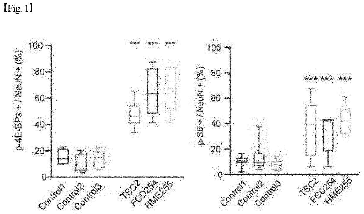 Composition for diagnosis or treatment of a condition associated with increased activity of eif4e comprising an eif4e inhibitor