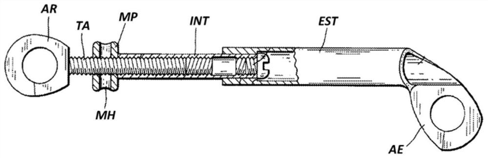 Mandibular advancement device and procedure for the realization of such device