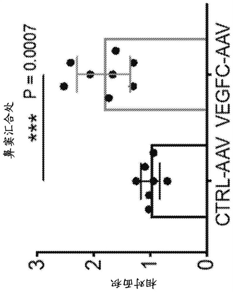 Manipulation of meningeal lymphatic vasculature for brain and CNS tumor therapy