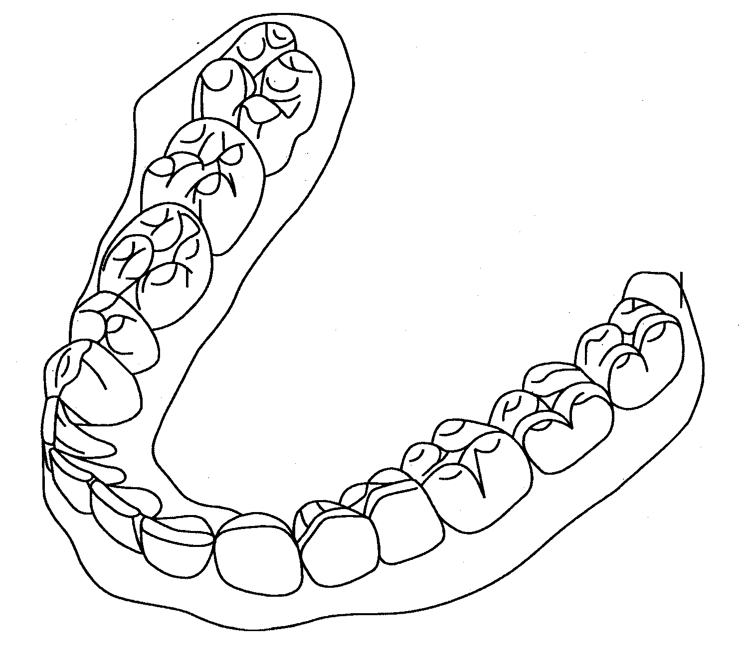 Dental models and series of dental models, and methods and apparatus for making and using same