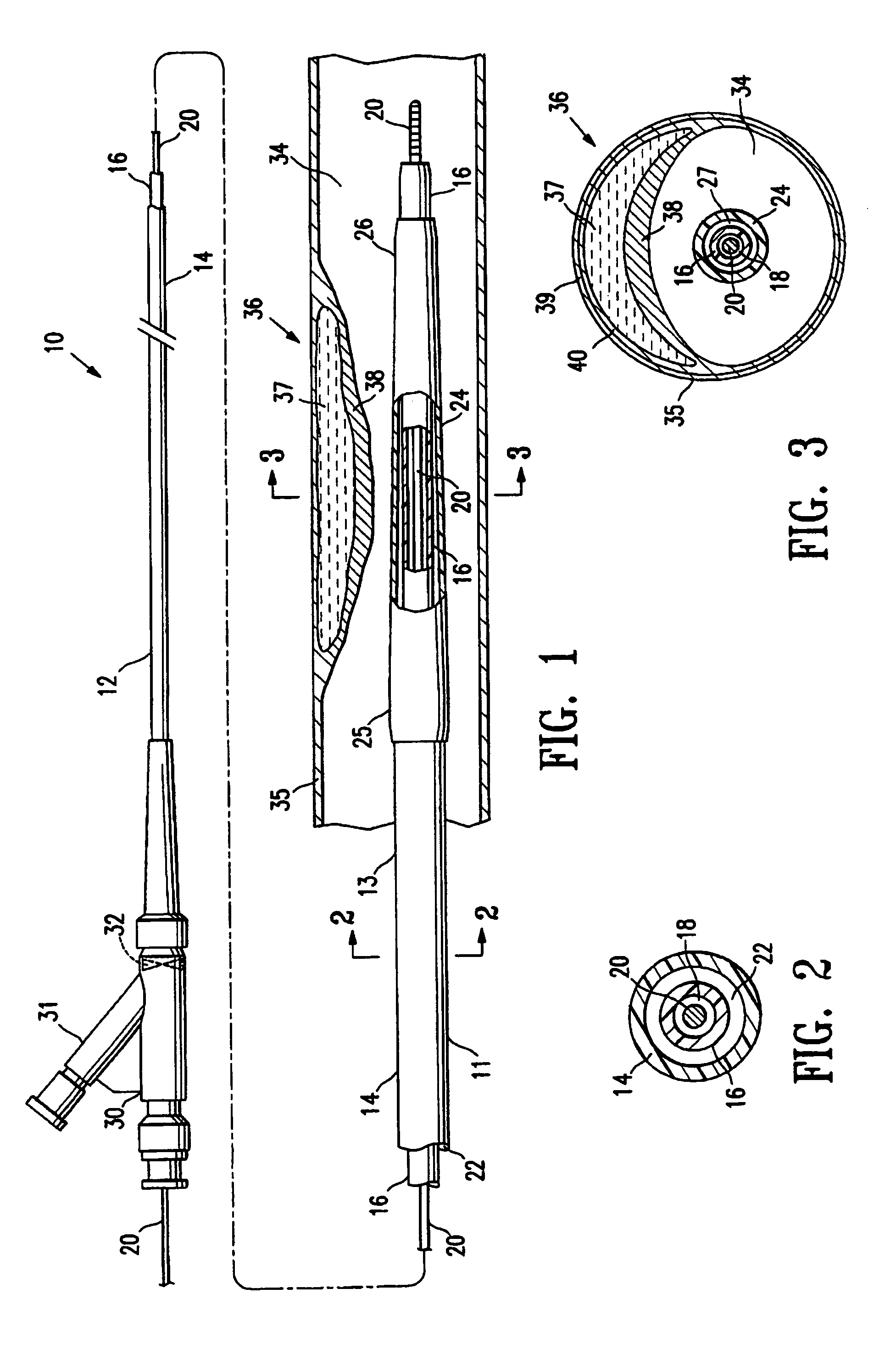 Method of treating vulnerable plaque