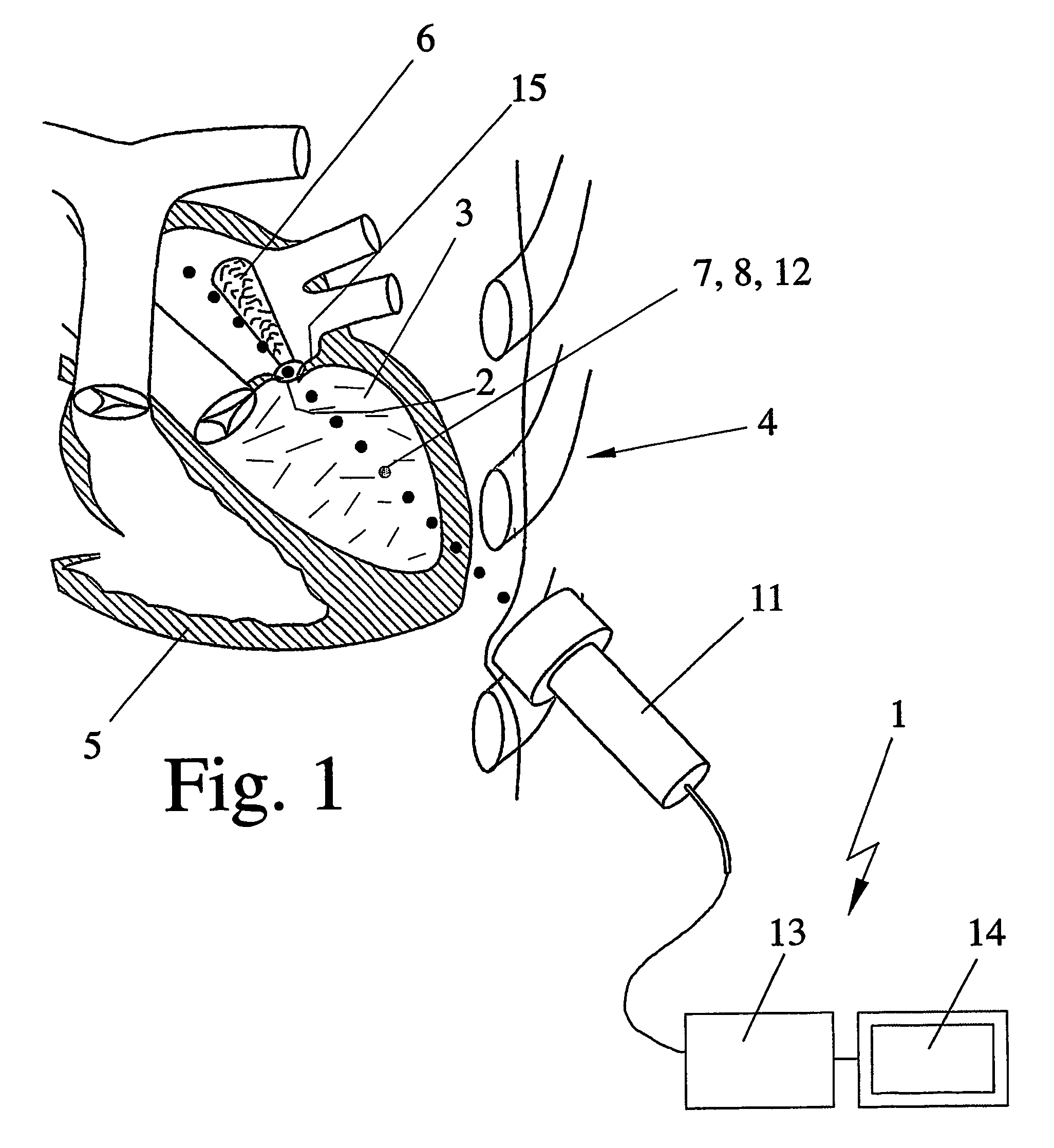 Method and device for ultrasound measurement of blood flow