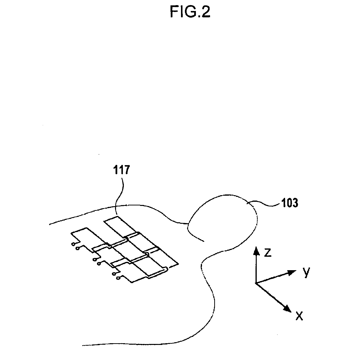 Magnetic resonance imaging system