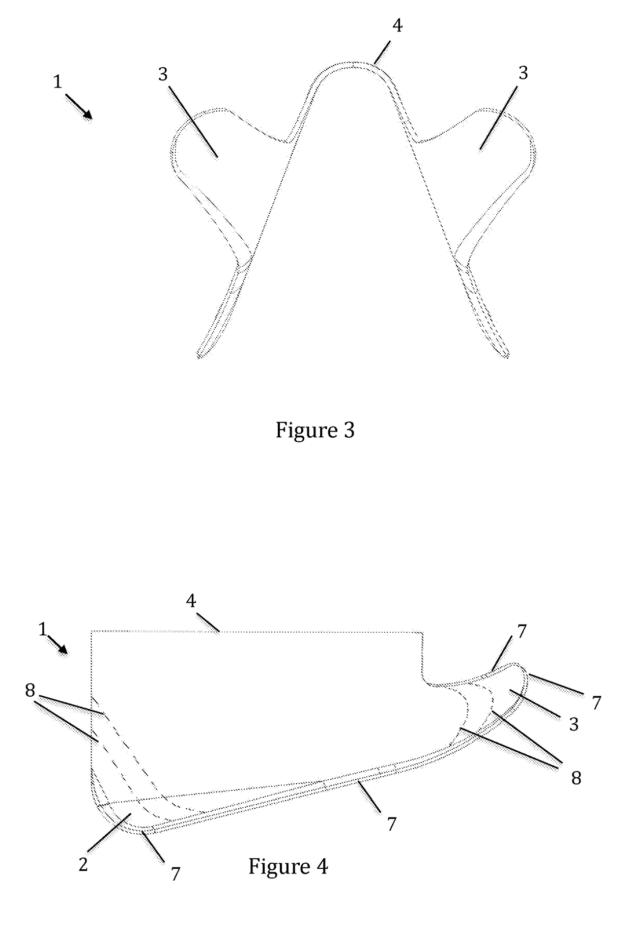 A nasal splint