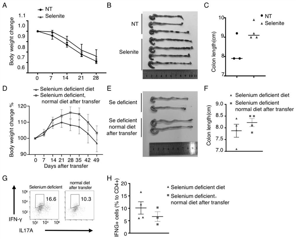 Application of selenium preparation in preparation of medicine for treating Crohn disease