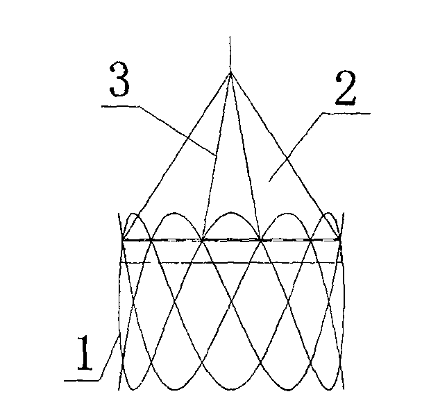 Bracket for lung volume reduction