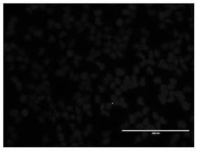 Tpl2-deficient MDCK cell strain as well as construction method and application thereof