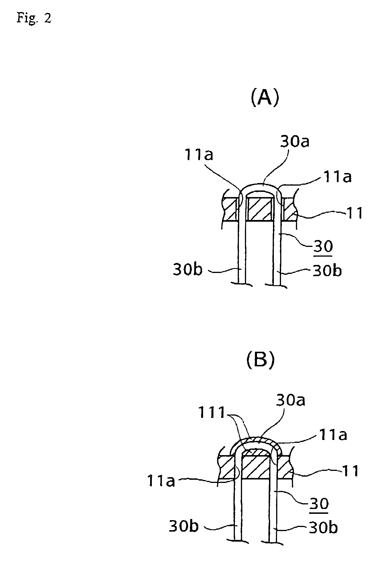 Hair-transplanting apparatus and method and resulting hair-transplanted piece