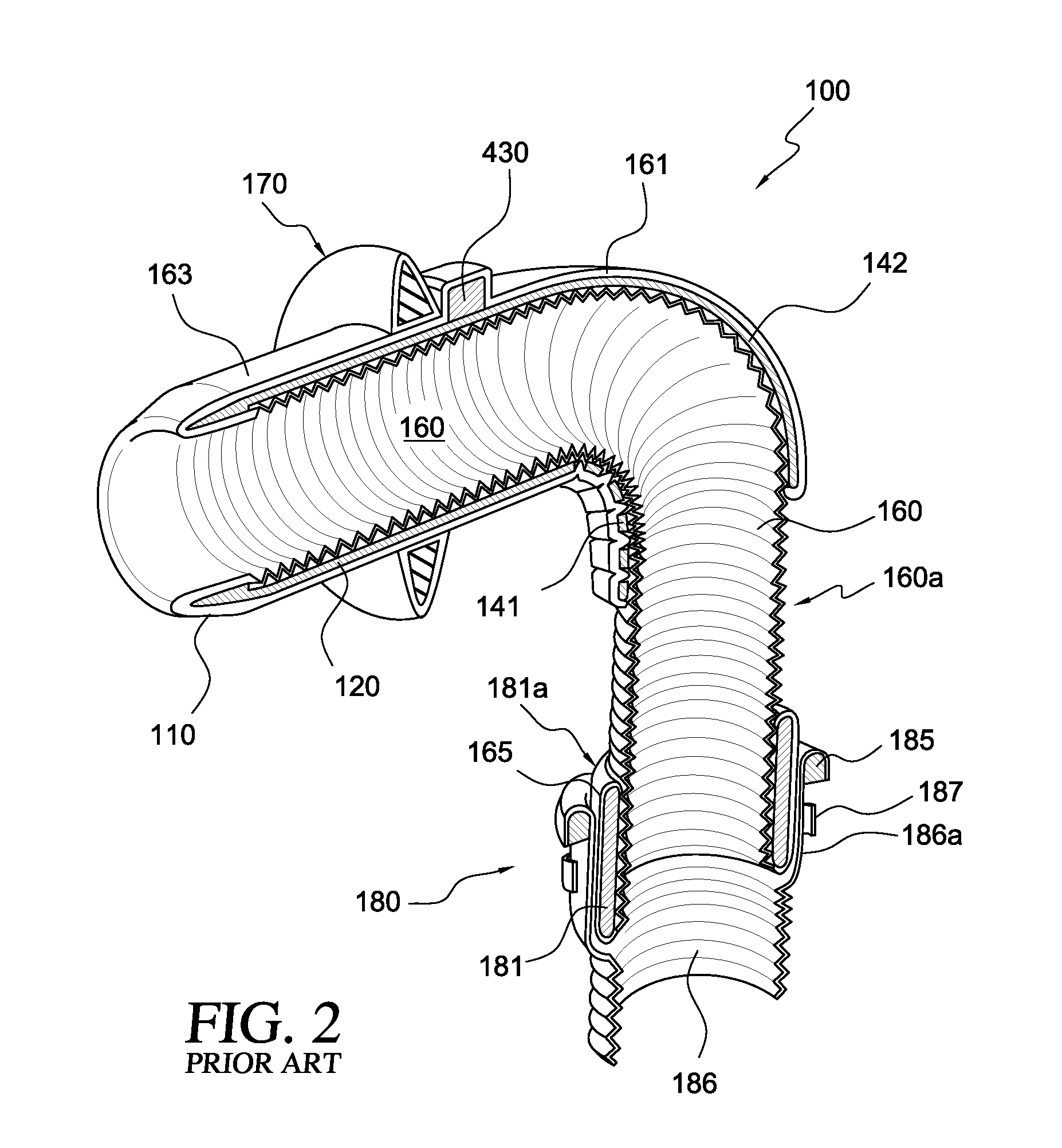 Applicator, assembly, and method for connecting an inlet conduit to a hollow organ