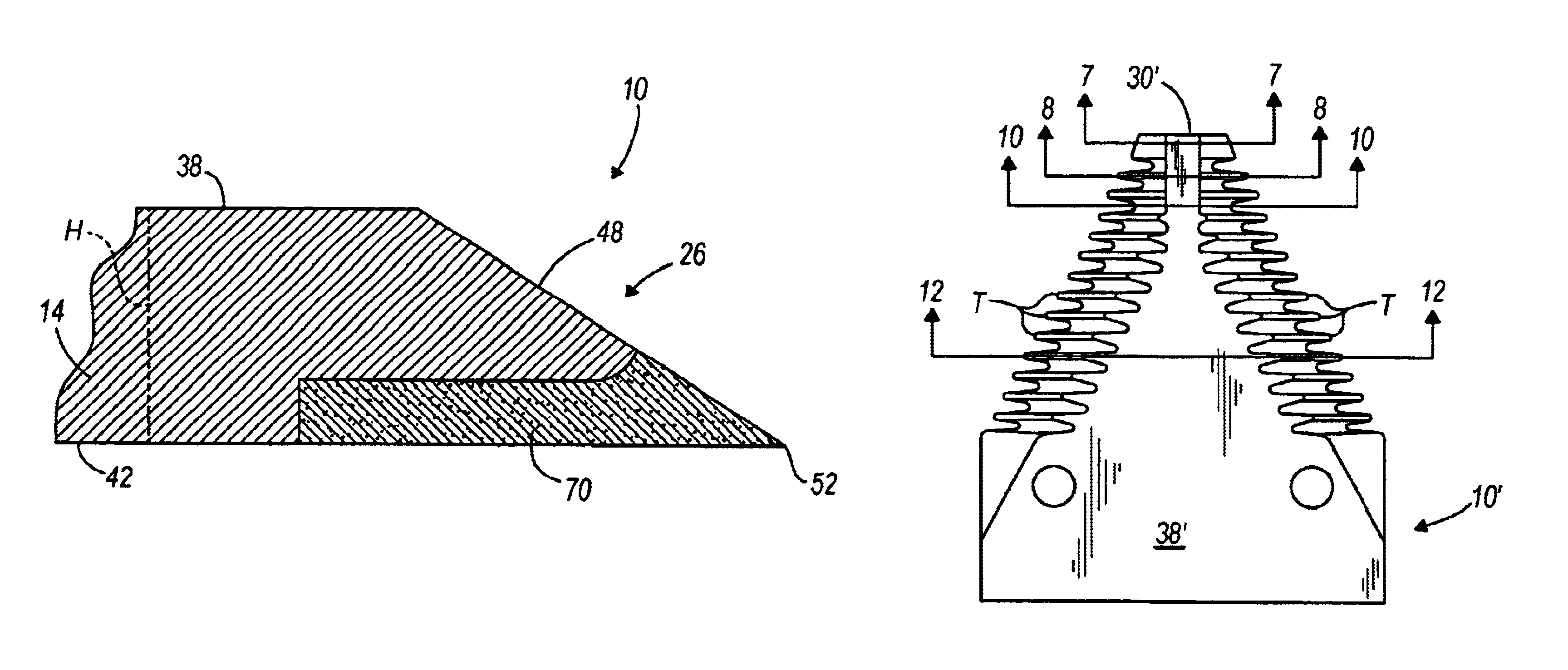 Reciprocating cutting blade having laser-hardened cutting edges and a method for making the same with a laser