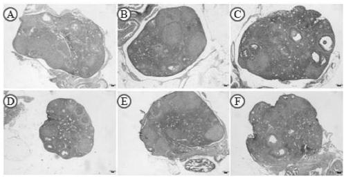 Application of Wubi Shanyao pills to preparation of POI (premature ovarian insufficiency) treatment drug