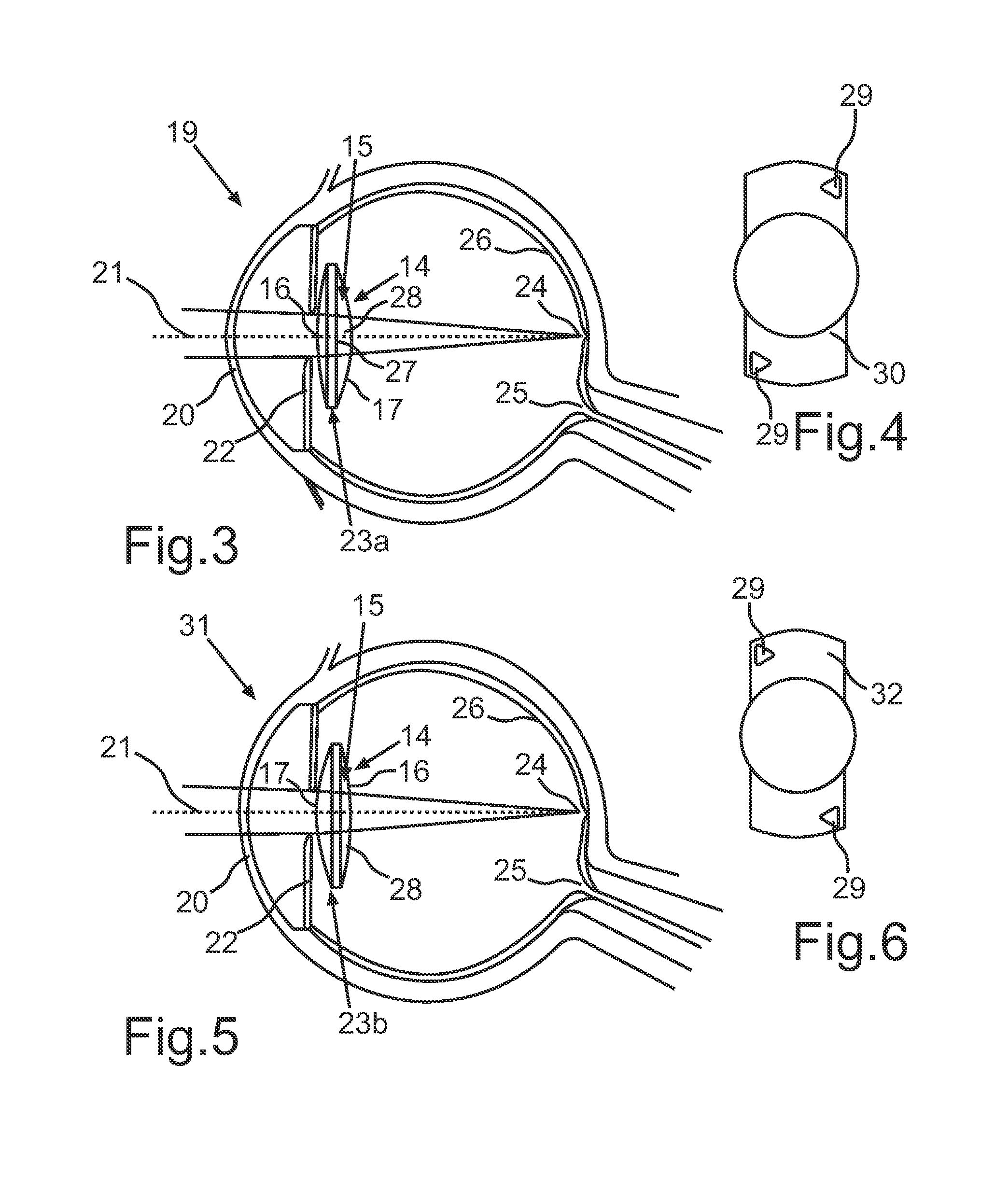 Method For Modelling An Intraocular Lens And Intraocular Lens