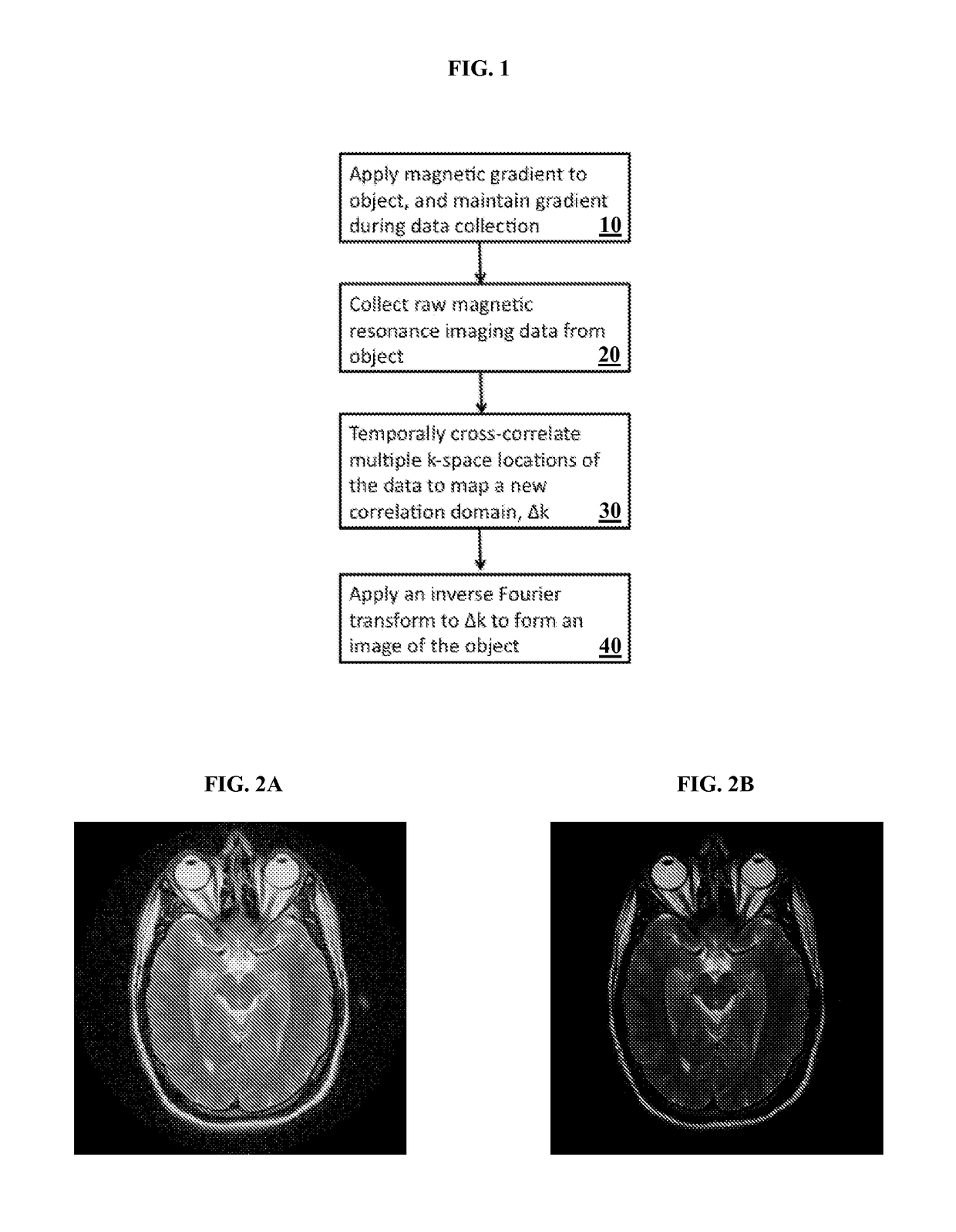 Interferometric techniques for magnetic resonance imaging