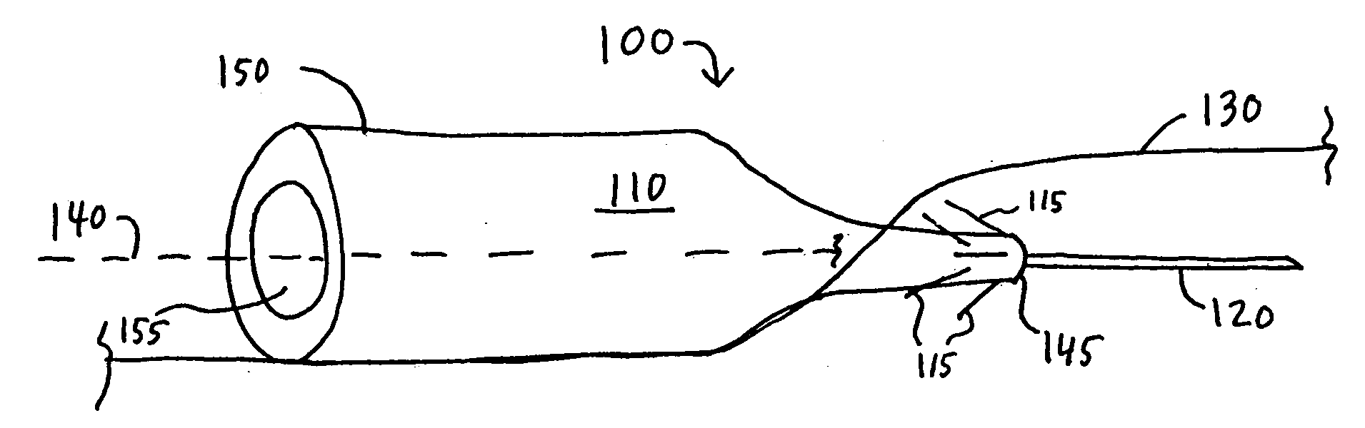 Self-anchoring catheter and method for using same