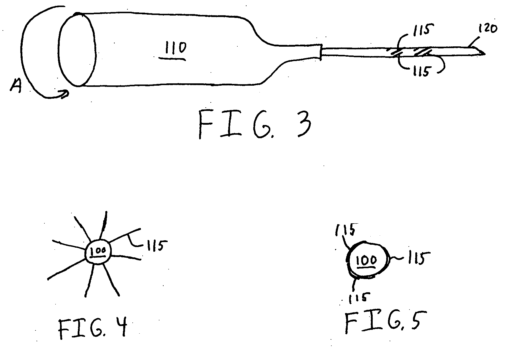 Self-anchoring catheter and method for using same