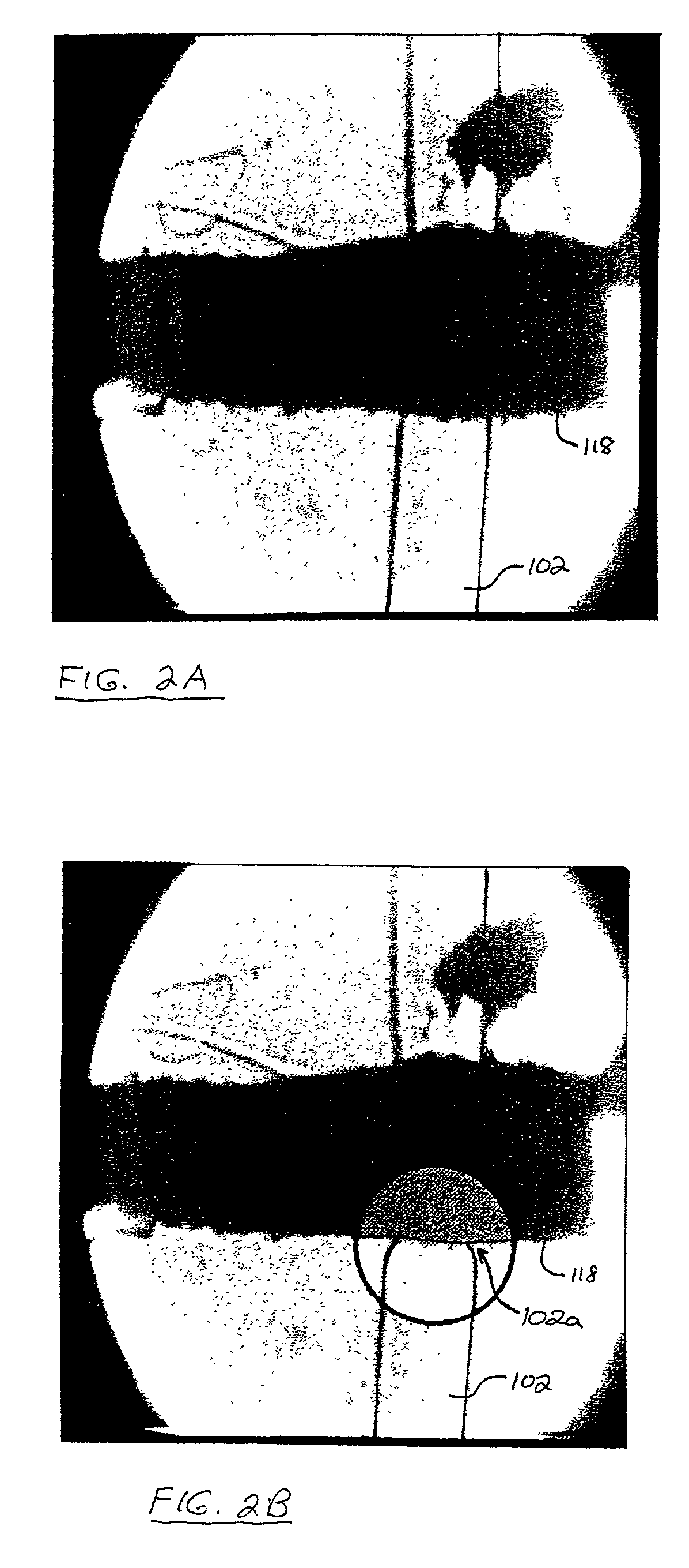 Electrostatic valves for microfluidic devices