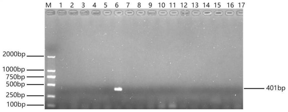 A kind of specific primer, method and application for detecting Acinetobacter towneri