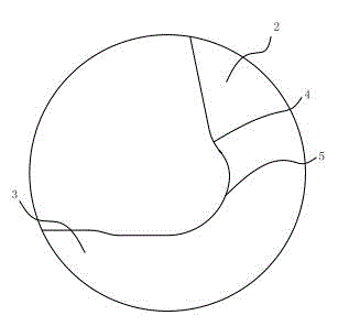 Novel angle aluminum structure