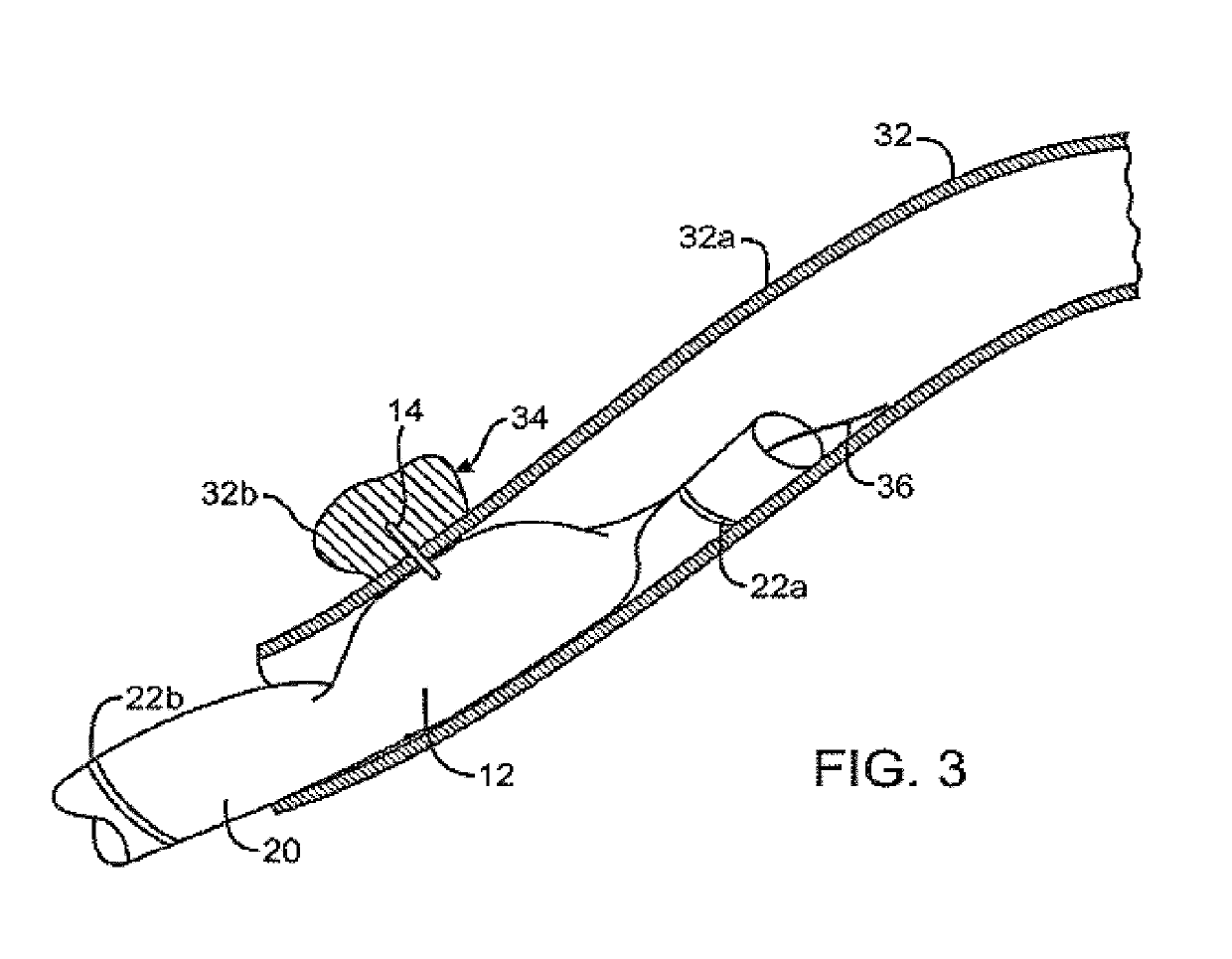 Combination therapy for treatment of restenosis