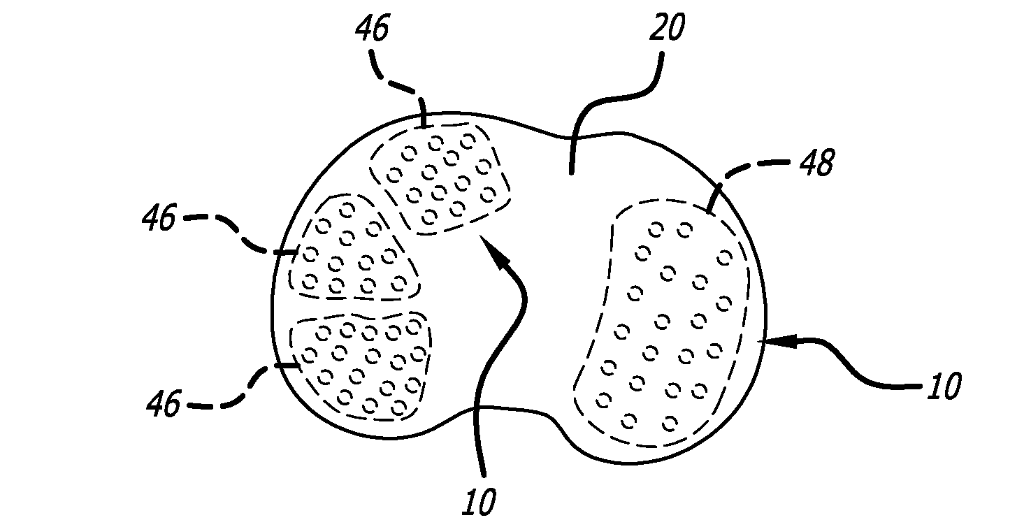 Joint support and subchondral support system