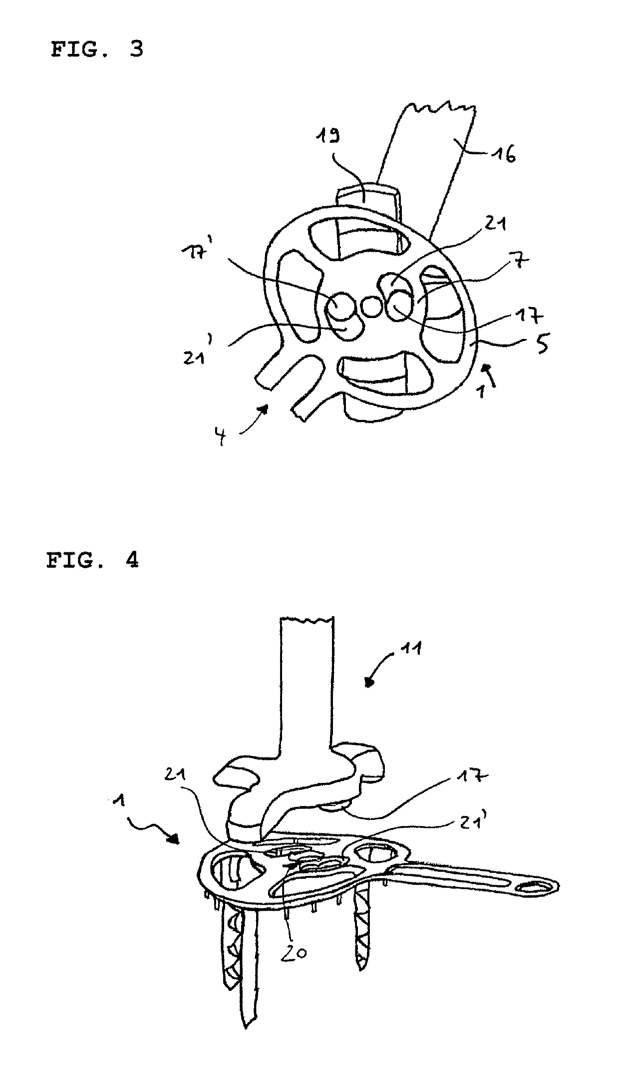 Tendon fixation plate