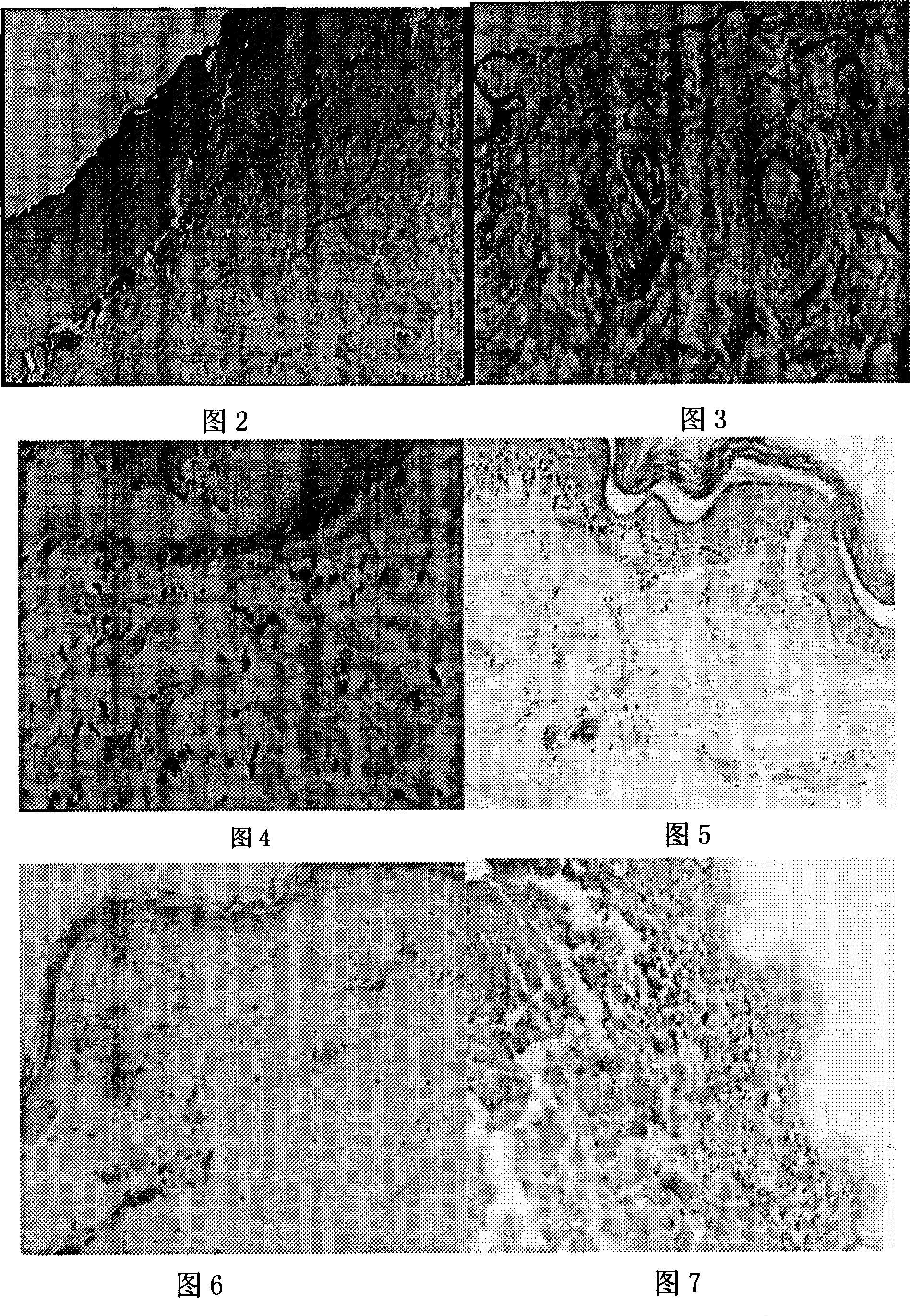 Medicinal composition for treating burn and its preparing method