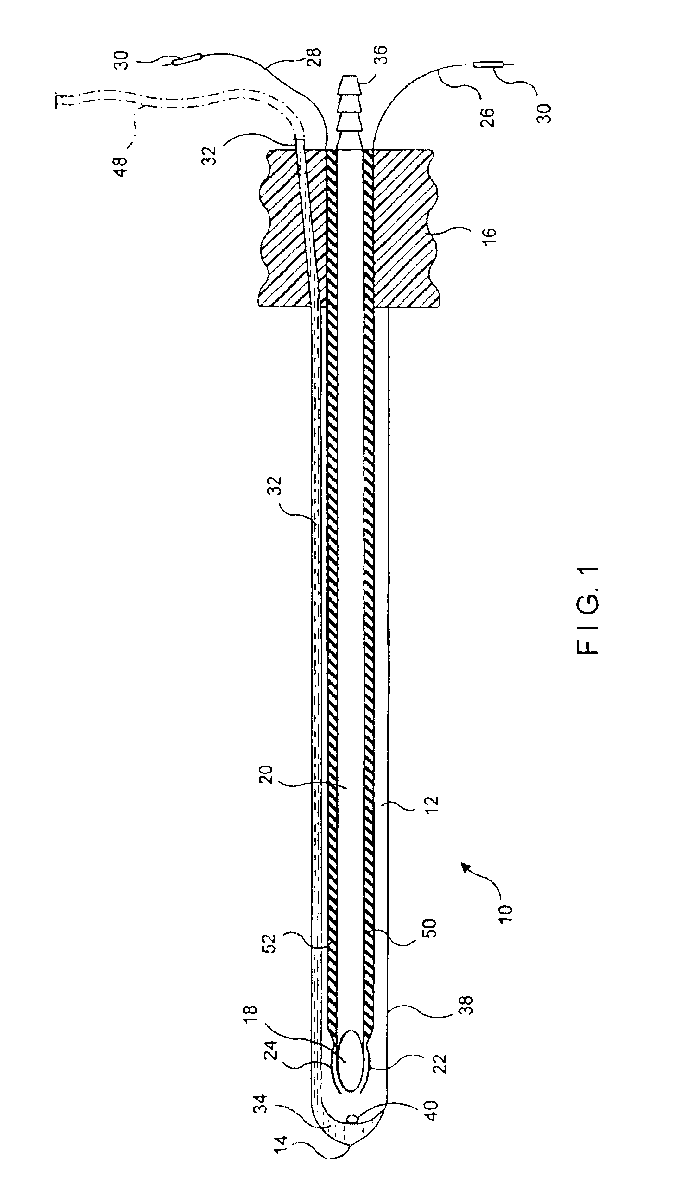 Device for suction-assisted lipectomy and method of using same