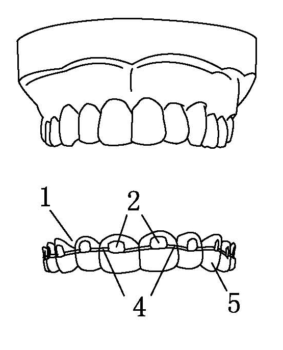 Bracket positioning template