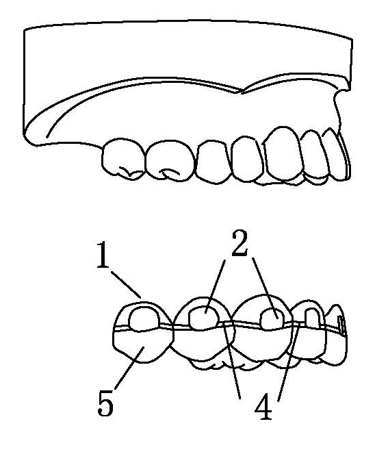 Bracket positioning template