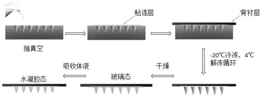 Preparation method of exenatide microneedle