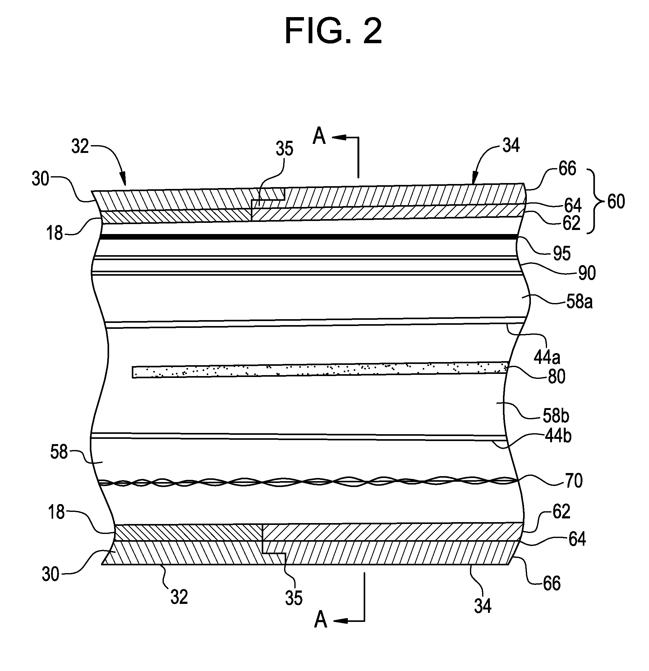 Force-sensing catheter with bonded center strut