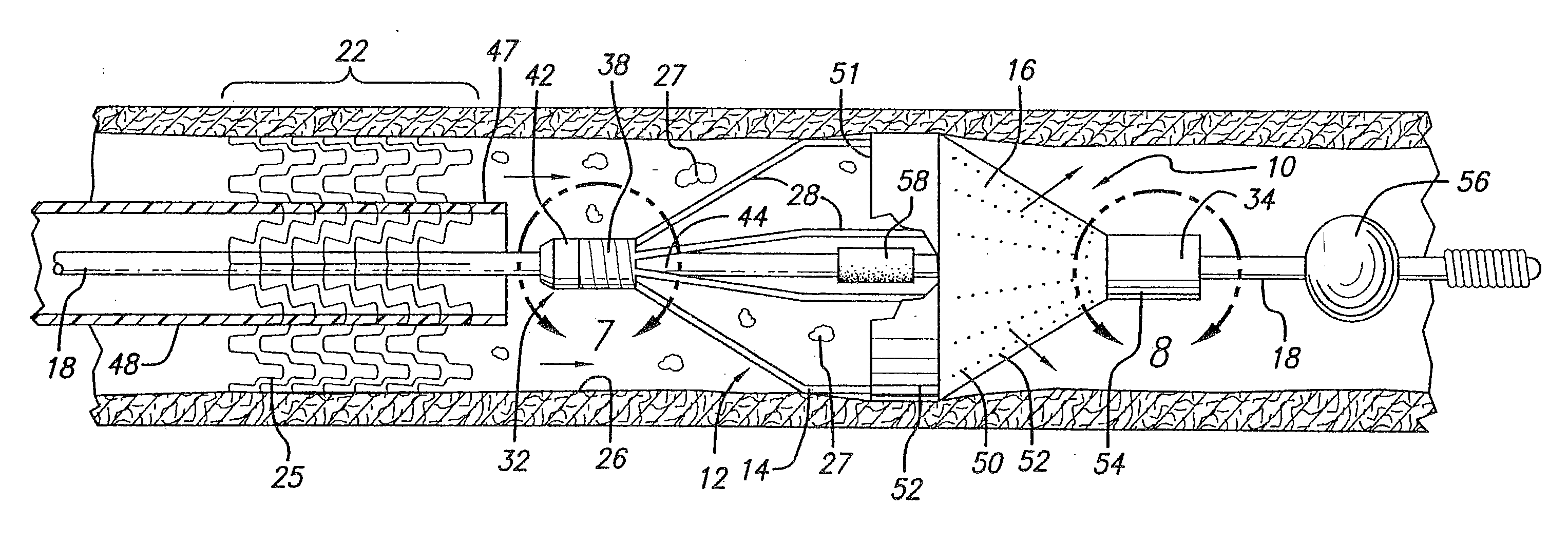 Embolic protection devices