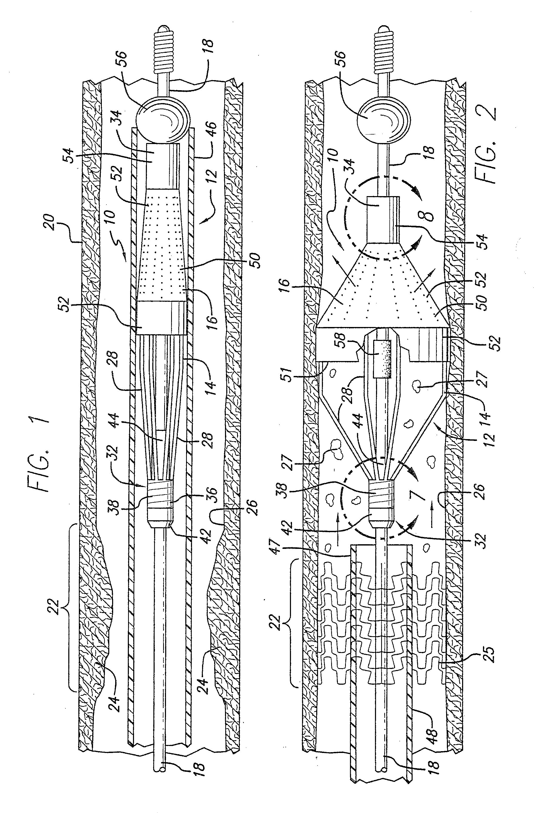 Embolic protection devices