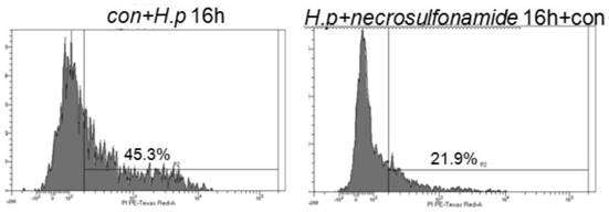 Application of gsdmd inhibitor in preparation of medicine for treating helicobacter pylori infection