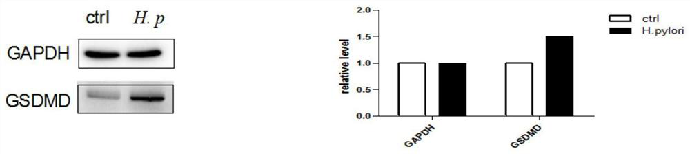 Application of gsdmd inhibitor in preparation of medicine for treating helicobacter pylori infection