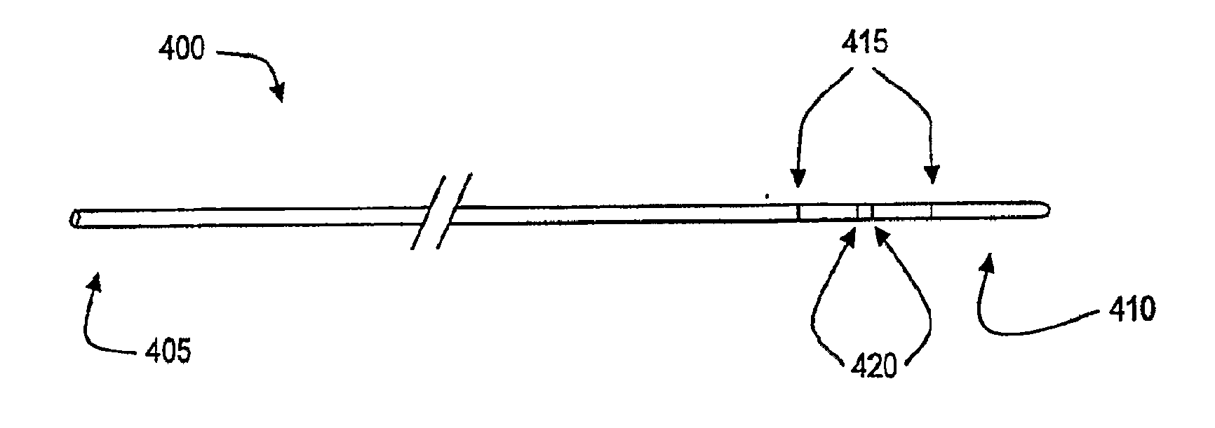 Body lumen junction localization