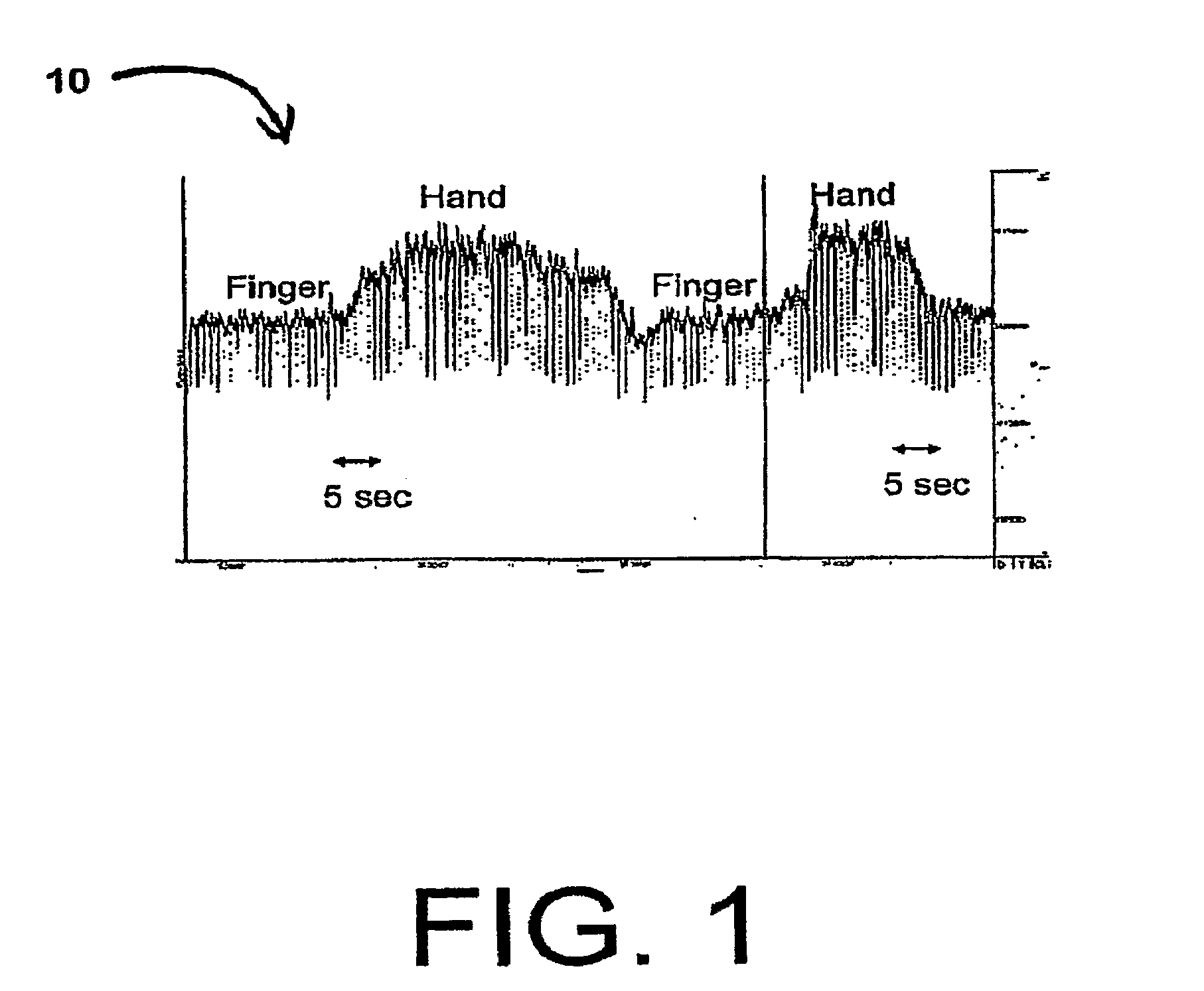 Body lumen junction localization