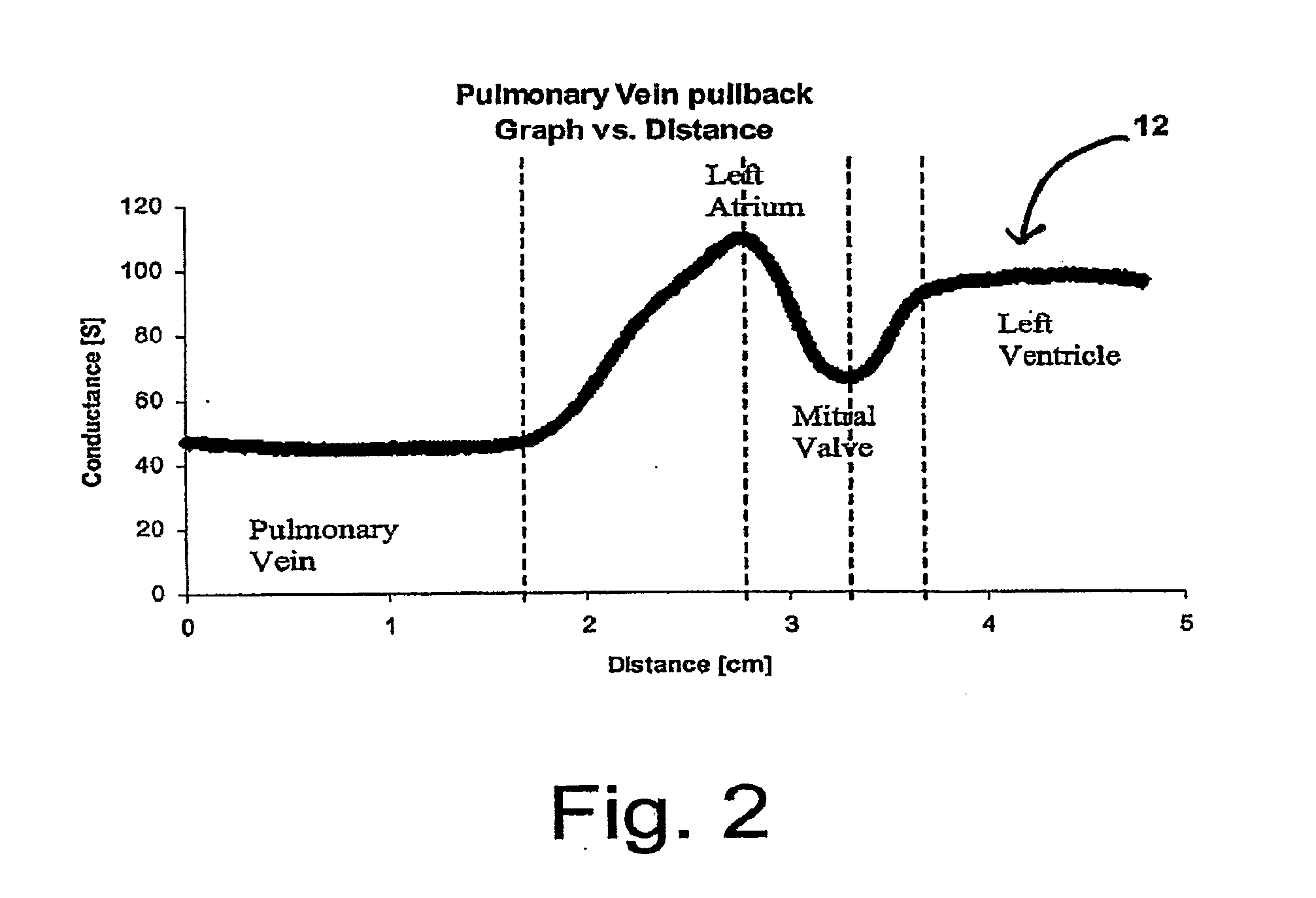 Body lumen junction localization