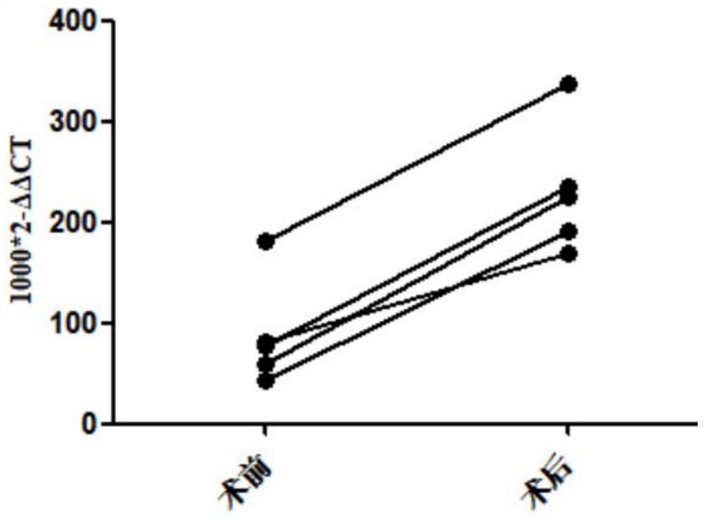 Application of SEPT9 mRNA in exosome in diagnosis of breast cancer