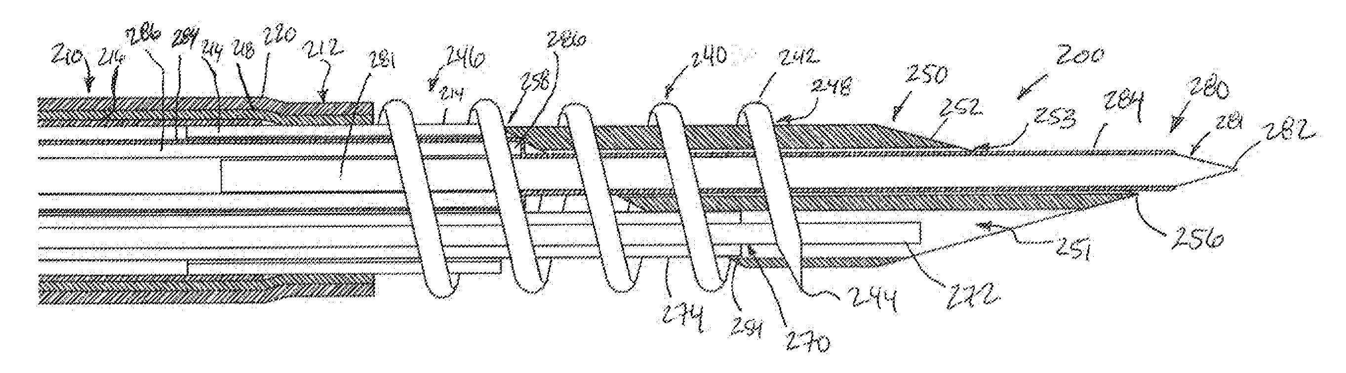 Transmuscular left ventricular cardiac stimulation leads and related systems and methods