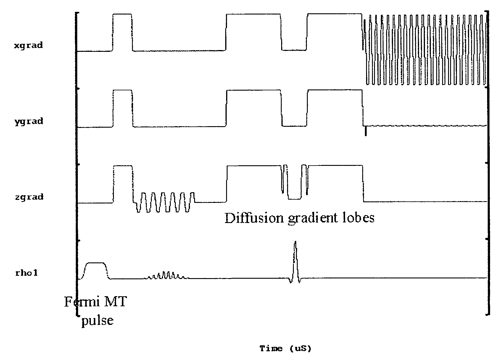 Method for differentiating tissues in magnetic resonance imaging