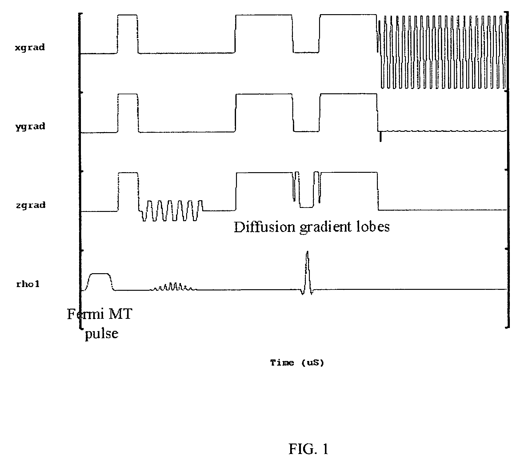 Method for differentiating tissues in magnetic resonance imaging