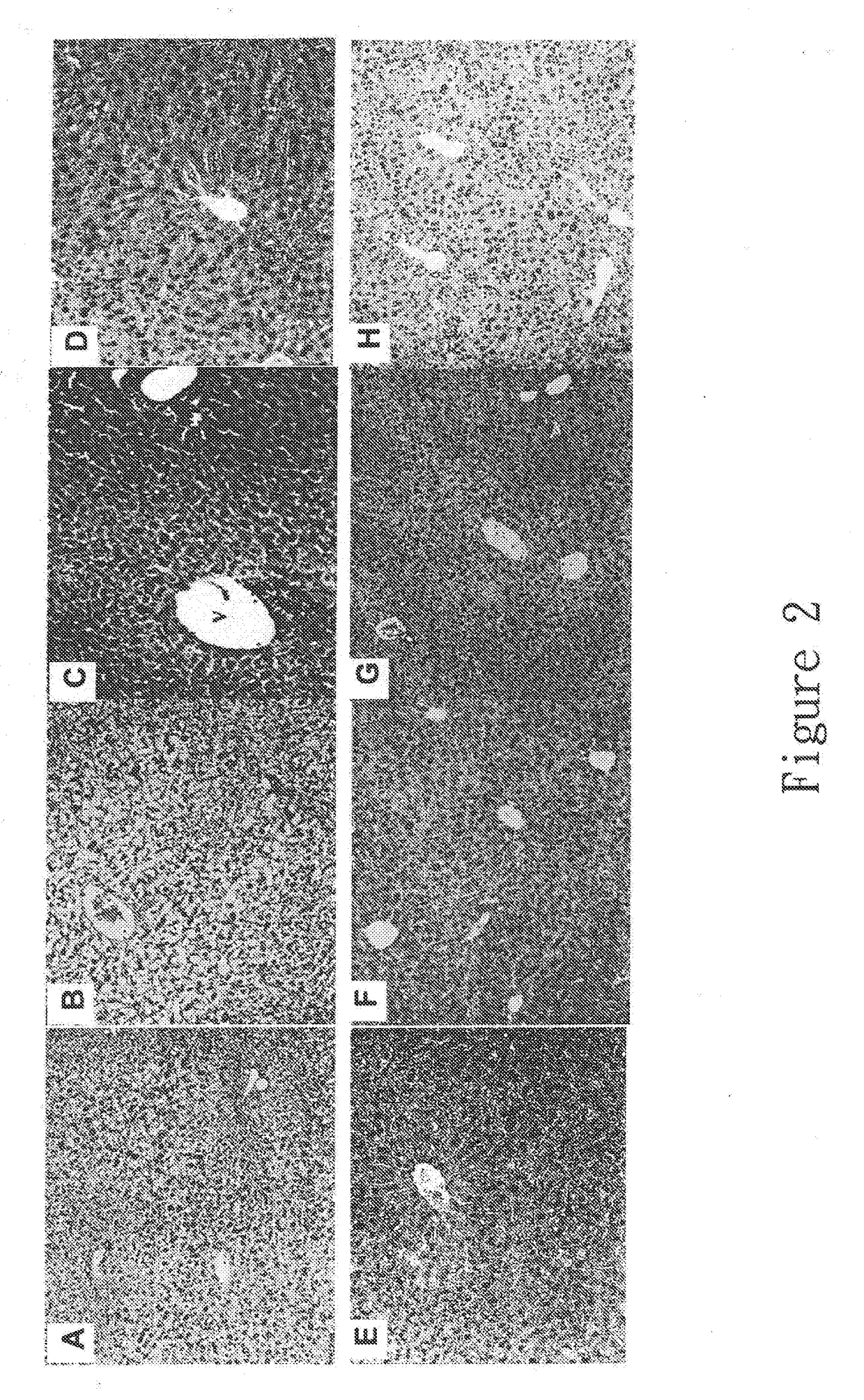 New hepatotoxicity-free pharmaceutical composition containing acetaminophen drugs