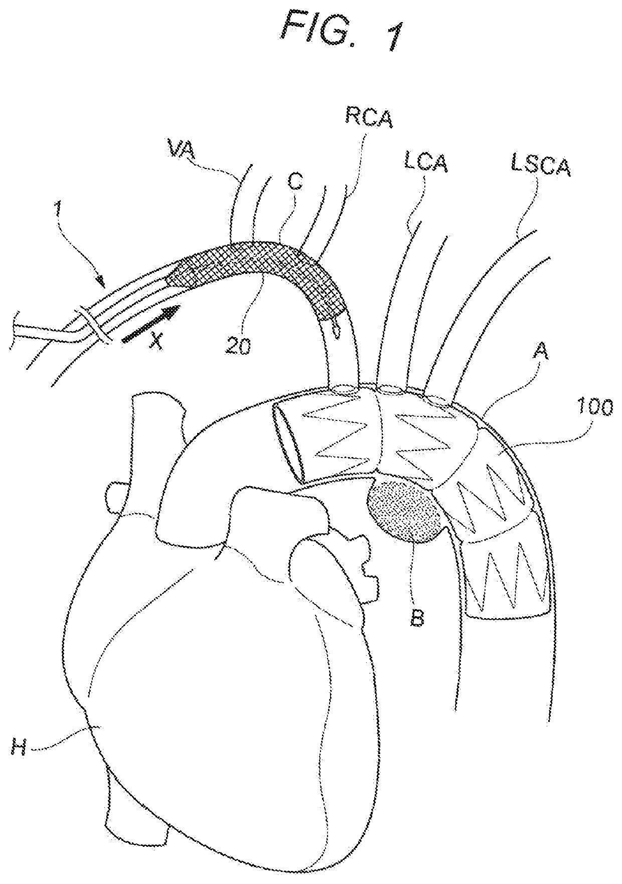 Filter device