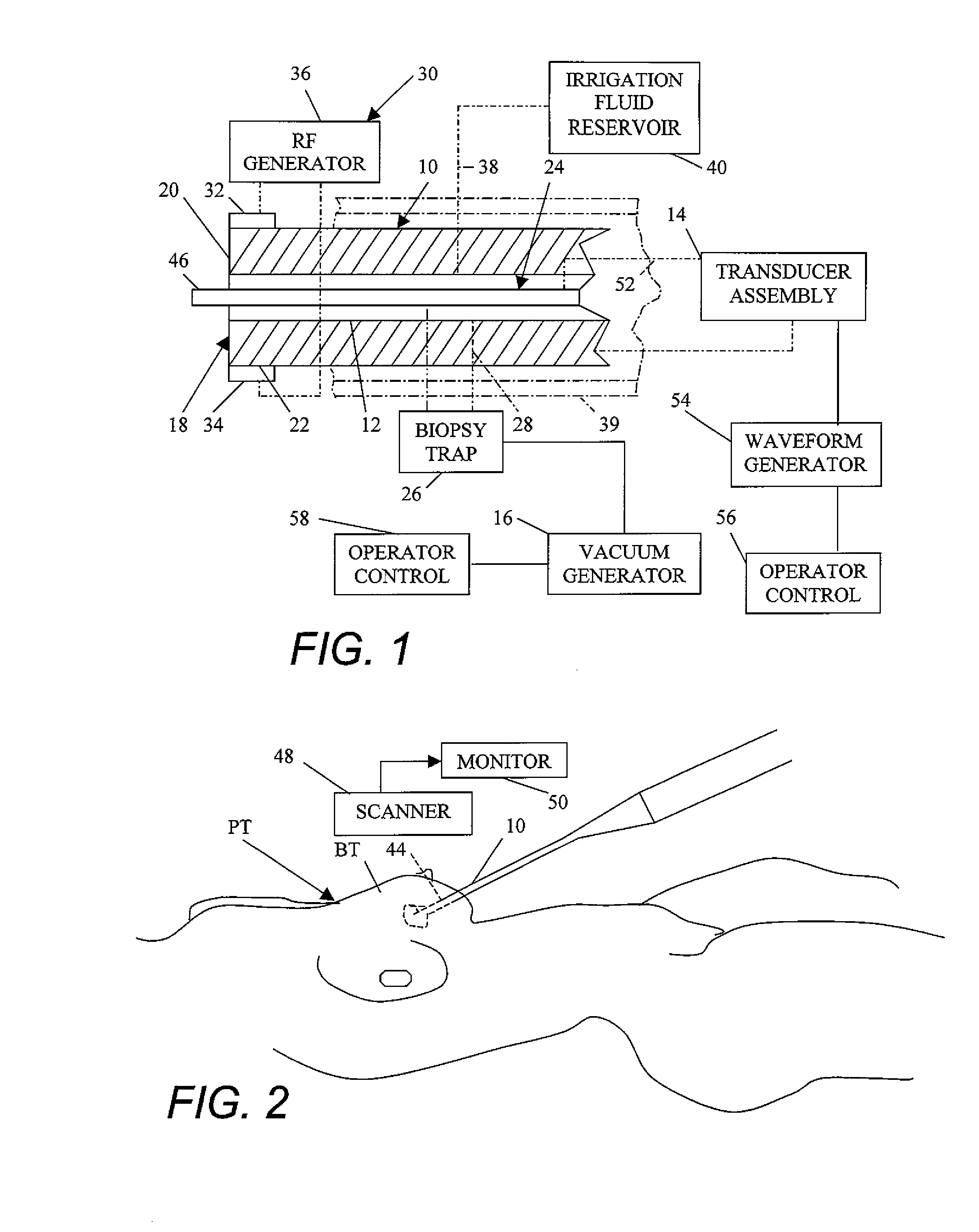 Treatment of breast disease with vibrating device