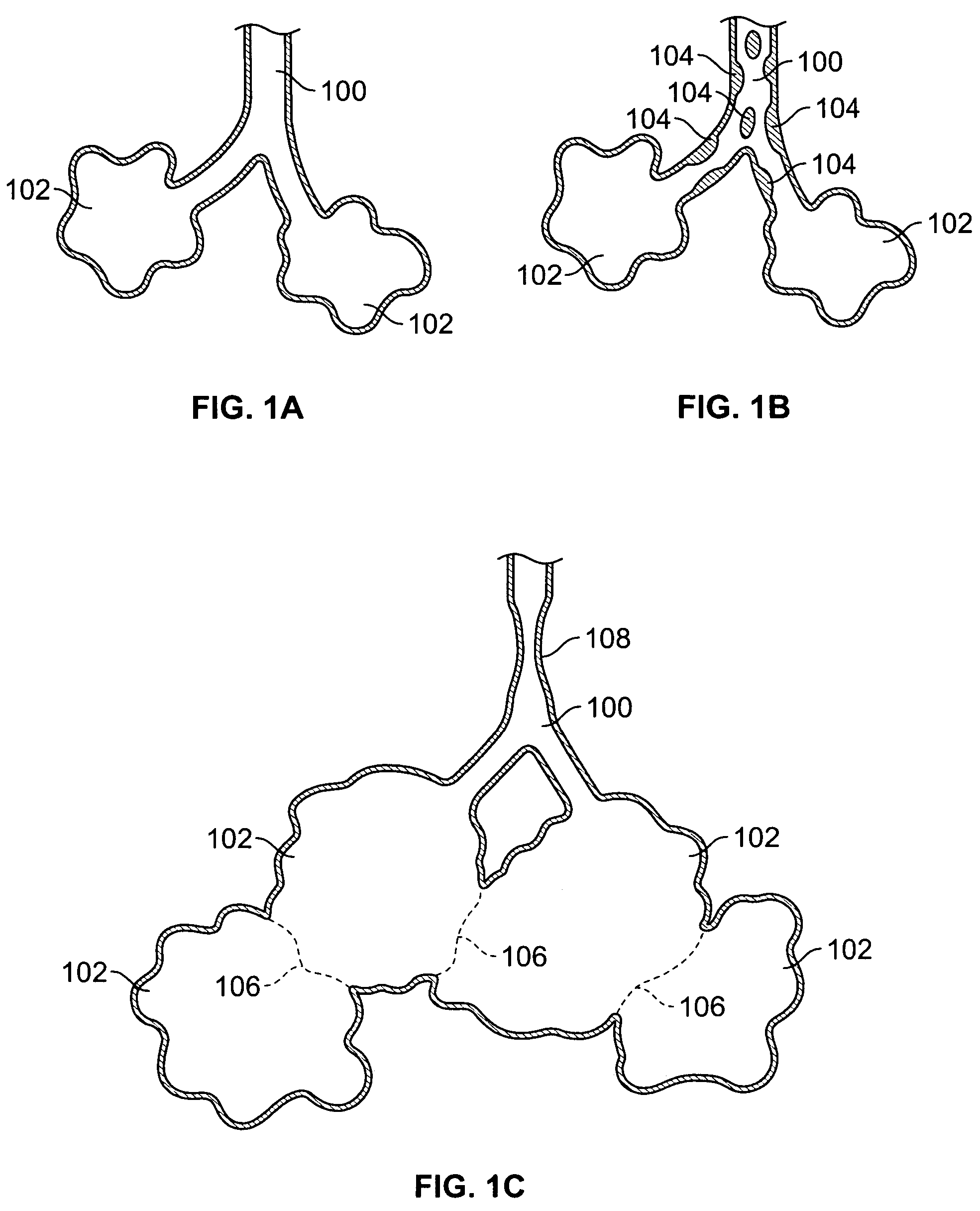 Methods and devices for maintaining patency of surgically created channels in a body organ