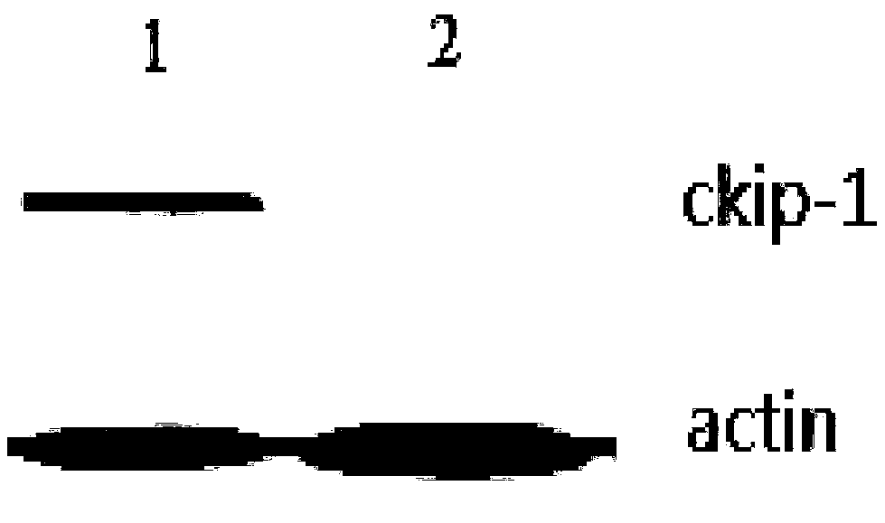 CKIP-1 RNAi compound of macrophage targeted and preparation method and application thereof