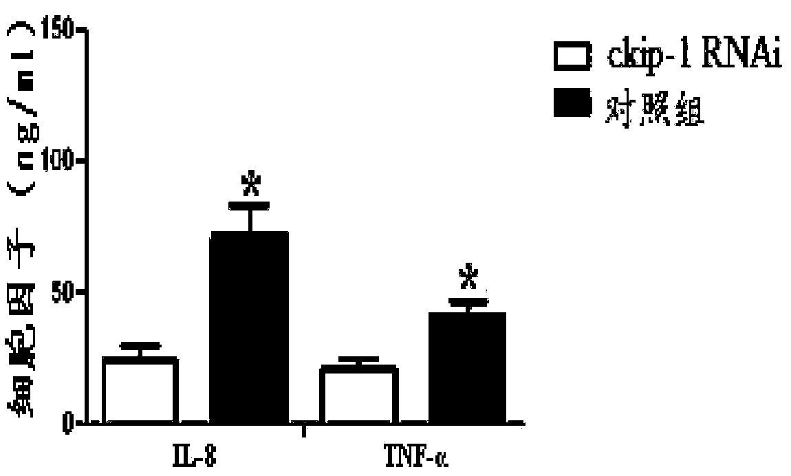 CKIP-1 RNAi compound of macrophage targeted and preparation method and application thereof