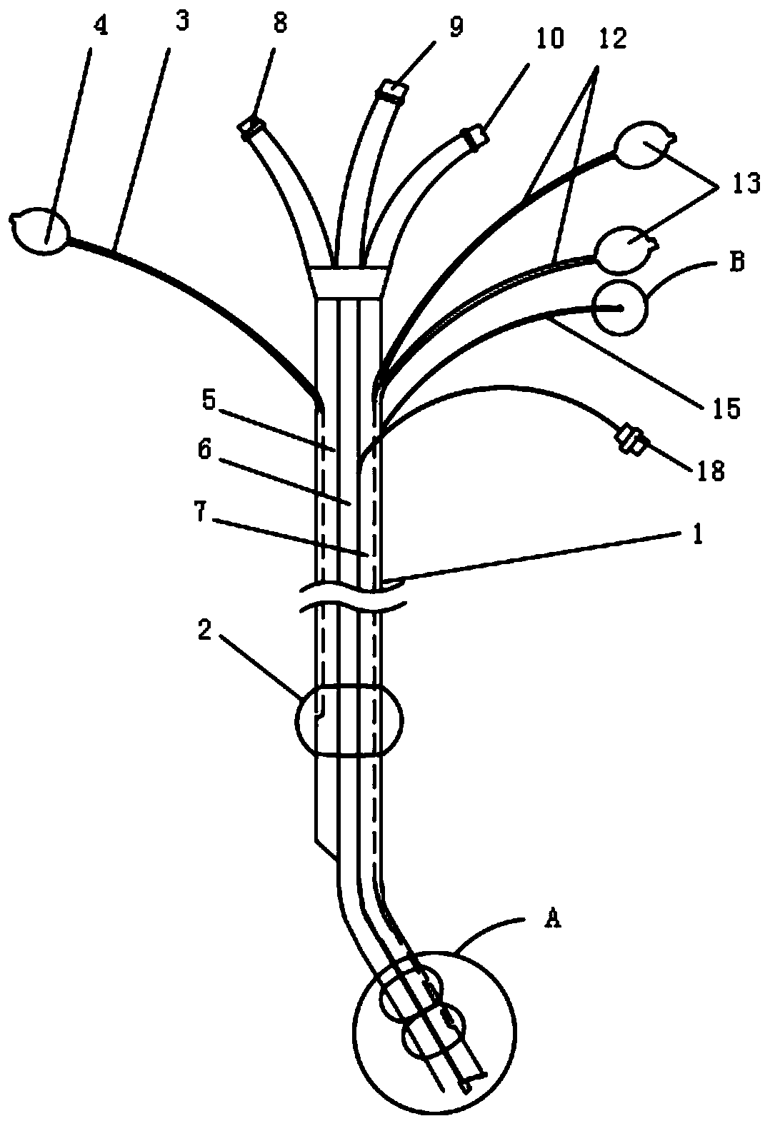 Three-cavity bronchial cannula for practical ultrasonic lung lavage